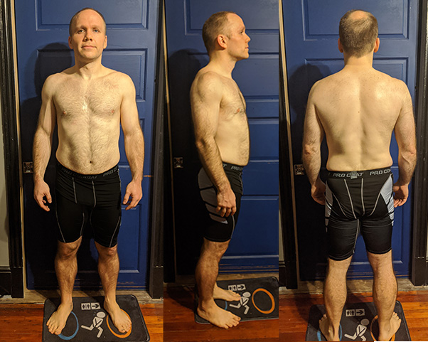 Day 1 - Front, Side & Back Day 1 - Front, Side & Back